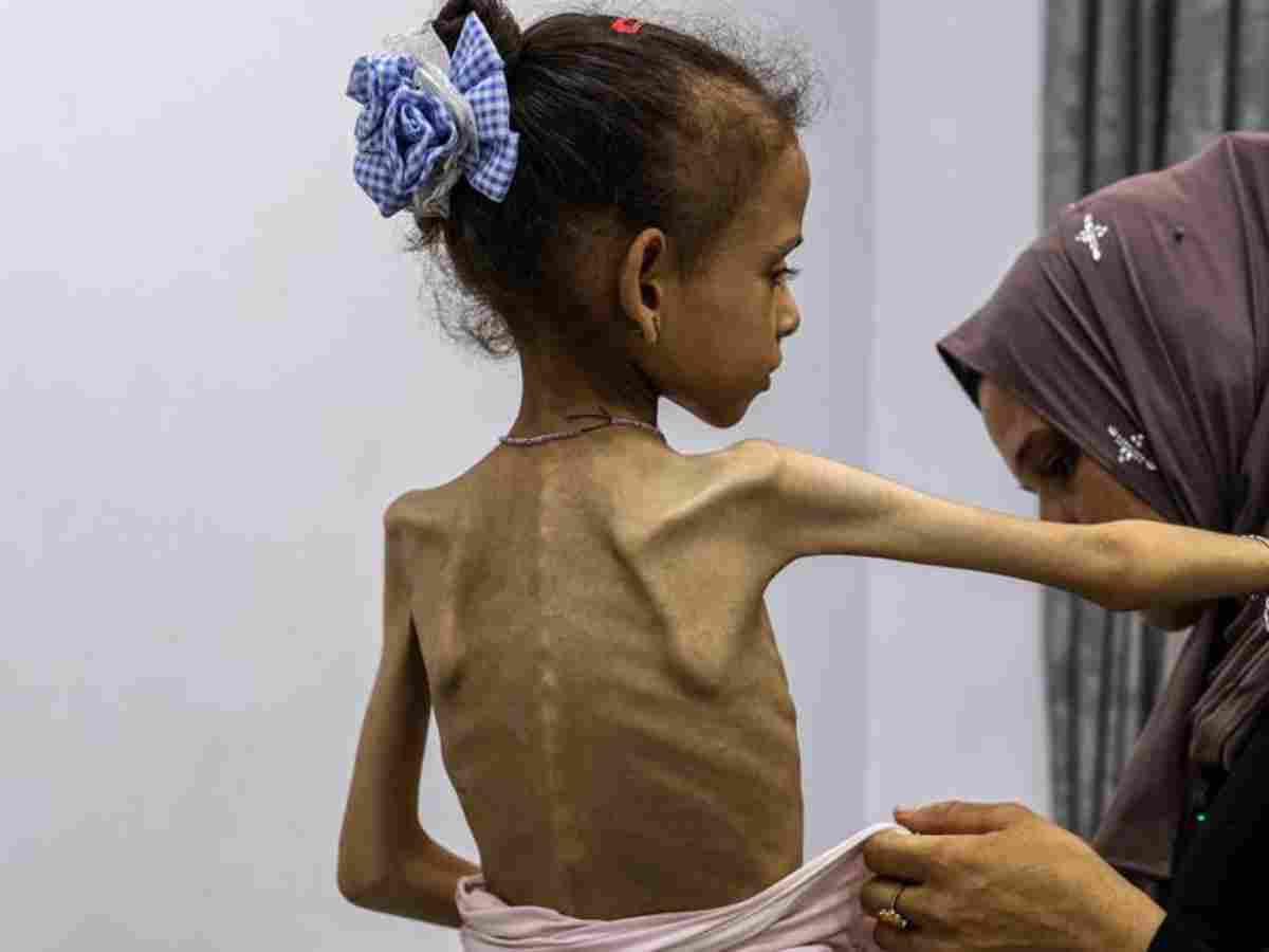 Israel leaves one million women and girls facing starvation