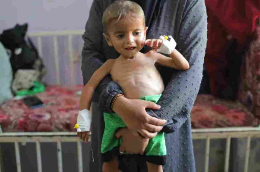 UN declares first ever famine in the Middle East