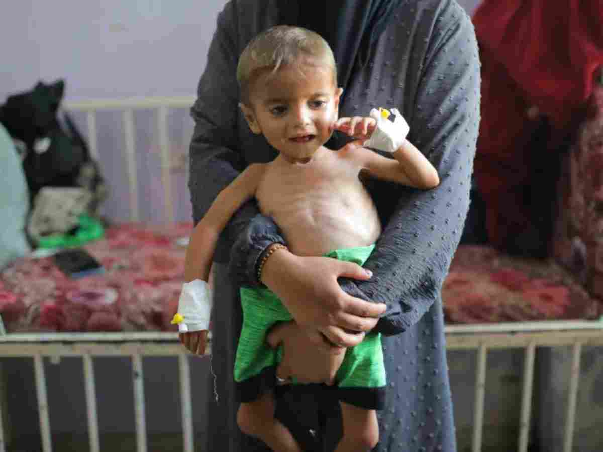 UN declares first ever famine in the Middle East