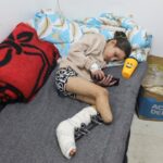 Gaza, where amputation has become the only option to save lives