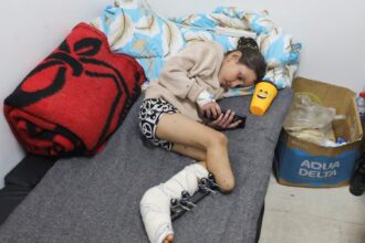 Gaza, where amputation has become the only option to save lives