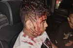 Israelis attack residents in West Bank, pepper spray 3-month-old