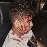 Israelis attack residents in West Bank, pepper spray 3-month-old