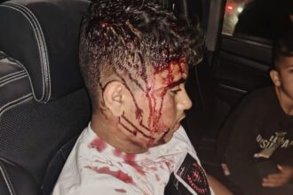 Israelis attack residents in West Bank, pepper spray 3-month-old