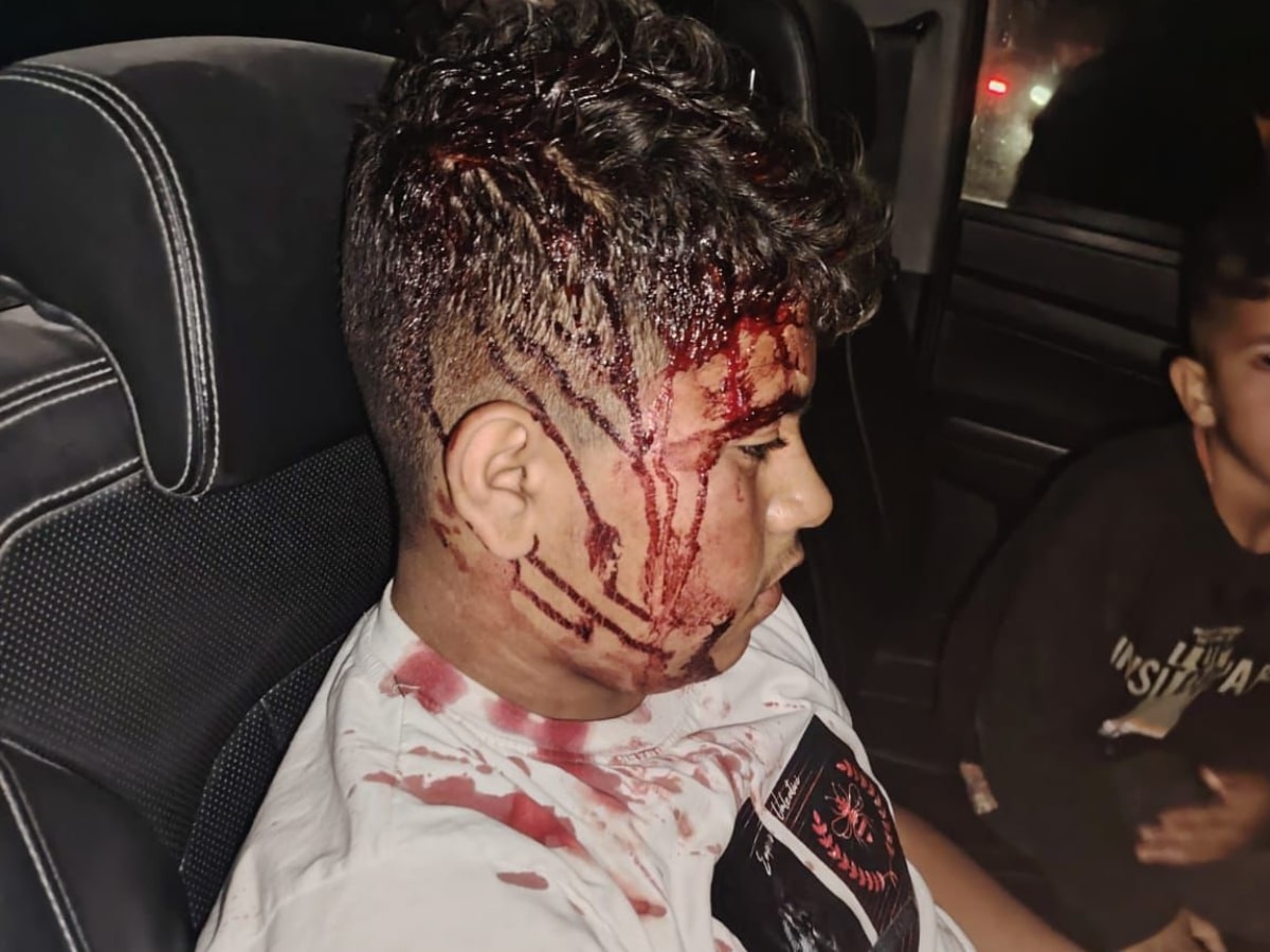 Israelis attack residents in West Bank, pepper spray 3-month-old