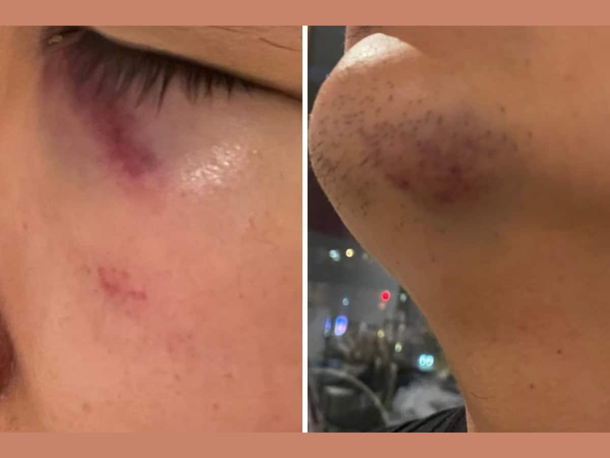 Racist attack in York after weeks of far-right flagging