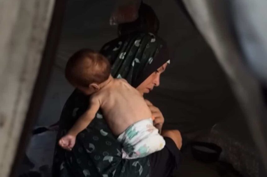 three-quarters of Gaza's children malnourished