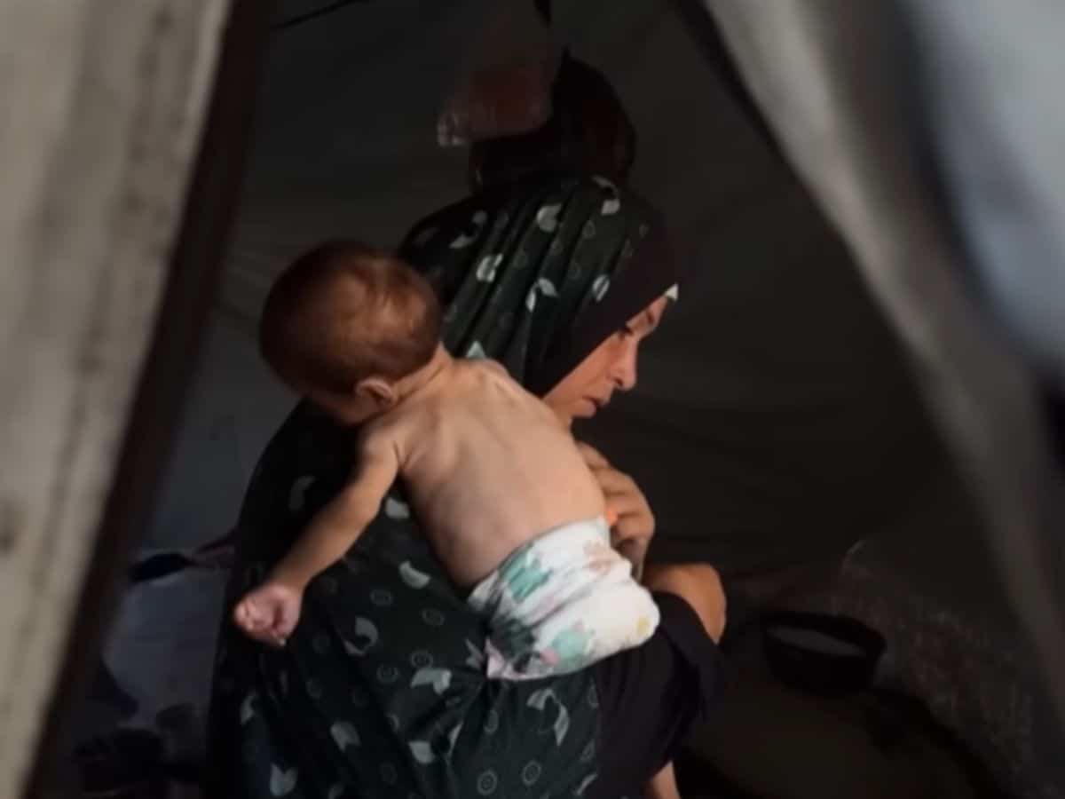 three-quarters of Gaza's children malnourished