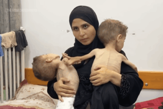 Gaza's children endure hunger and disease