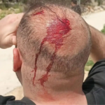 Israeli settler attacks intensify against Palestinians in West Bank