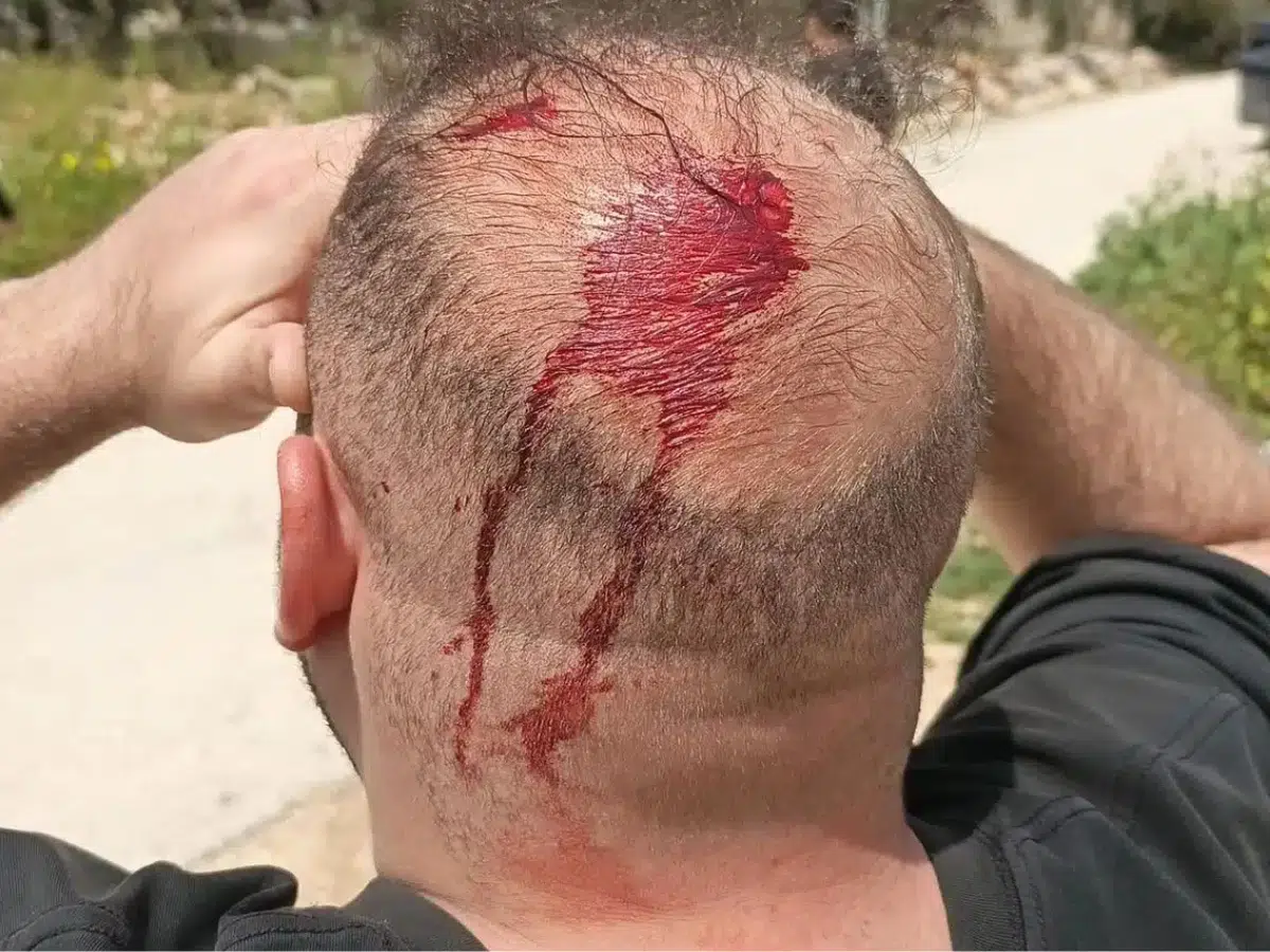 Israeli settler attacks intensify against Palestinians in West Bank