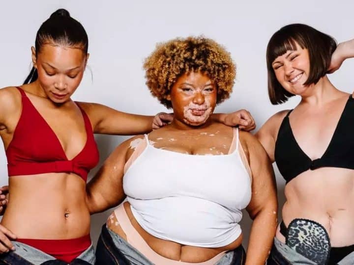 Read more about the article Young adaptive clothing line hosts first Disability Pride Catwalk in Manchester