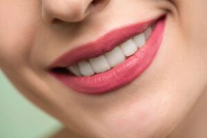 Read more about the article Smile Makeover vs Veneers: Understanding the Differences and Choosing the Right Option